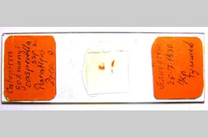 Catoptria gozmanyi casperella Ganev, 1983 [paratype NMNHSINV0323] (3) (c) National Museum of Natural History, BAS — Invertebrates Collection (NMNHS-INV)